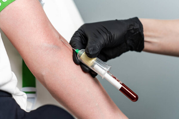 Unrecognizable Female Lab Assistant Black Medical Gloves Taking Venous Blood Royalty Free Stock Photos