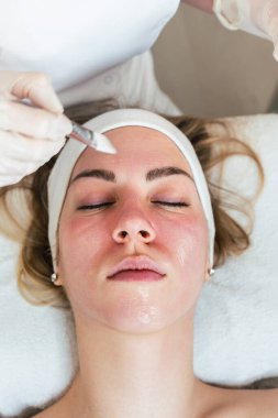 Genç bir kadın modern radyo frekanslı yüz sıkılaştırma tedavisi görüyor. Radyo dalgaları ile deri lezyonlarının çıkarılması için en popüler, zararsız kozmetik prosedürü. Radyodalga ameliyatı.