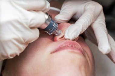 Genç bir kadın deri dökülmesi, yenilenmesi ve yüz derisinin sulanması için Hydra yüz tedavisi görüyor. Modern yüz hidro mikro cilt temizleme güzellik prosedürü. Hidra elektrikli süpürge.. 