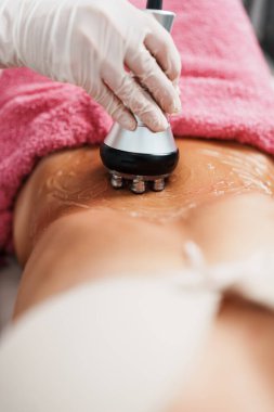 Cavitation RF bedeni ve sağlık güzelliğinin iyileştirilmesi ve yağ ve selülit alınması için çağdaş ilaçlar