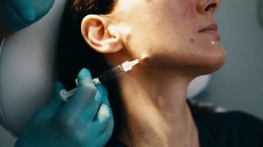 Çekici genç bir kadın güzellik kliniğinde gençleştirici yüz enjeksiyonu yaptırıyor. Güzellik uzmanı kadın kırışıklıklarını botulinyum toksin iğneleriyle ya da hyaluronik asit doldurucularıyla dolduruyor..