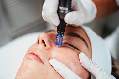 Profesyonel güzellik uzmanı genç güzel bir kadının yüzüne glikolik asit kabuğu yapıştırıyor. Kimyasal soyma ve güzellik tedavi konsepti.