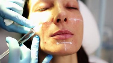 Çekici genç bir kadın güzellik kliniğinde gençleştirici yüz enjeksiyonu yaptırıyor. Güzellik uzmanı kadın kırışıklıklarını botulinyum toksin iğneleriyle ya da hyaluronik asit doldurucularıyla dolduruyor..