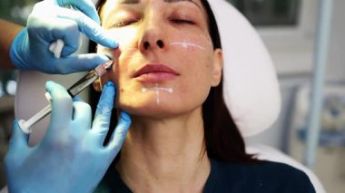 Çekici genç bir kadın güzellik kliniğinde gençleştirici yüz enjeksiyonu yaptırıyor. Güzellik uzmanı kadın kırışıklıklarını botulinyum toksin iğneleriyle ya da hyaluronik asit doldurucularıyla dolduruyor..