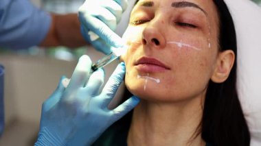 Çekici genç bir kadın güzellik kliniğinde gençleştirici yüz enjeksiyonu yaptırıyor. Güzellik uzmanı kadın kırışıklıklarını botulinyum toksin iğneleriyle ya da hyaluronik asit doldurucularıyla dolduruyor..