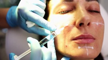 Çekici genç bir kadın güzellik kliniğinde gençleştirici yüz enjeksiyonu yaptırıyor. Güzellik uzmanı kadın kırışıklıklarını botulinyum toksin iğneleriyle ya da hyaluronik asit doldurucularıyla dolduruyor..