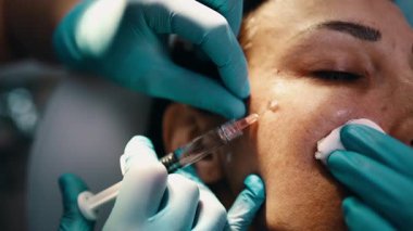 Çekici genç bir kadın güzellik kliniğinde gençleştirici yüz enjeksiyonu yaptırıyor. Güzellik uzmanı kadın kırışıklıklarını botulinyum toksin iğneleriyle ya da hyaluronik asit doldurucularıyla dolduruyor..