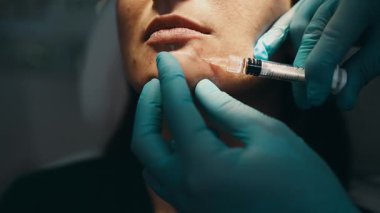 Çekici genç bir kadın güzellik kliniğinde gençleştirici yüz enjeksiyonu yaptırıyor. Güzellik uzmanı kadın kırışıklıklarını botulinyum toksin iğneleriyle ya da hyaluronik asit doldurucularıyla dolduruyor..