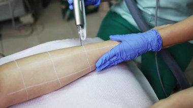 Profesyonel güzellik uzmanı, güzellik salonunda kadın bacağı üzerinde lazer tüyü çıkarma prosedürü uyguluyor. Etkili ve acısız vücut kıllarını almak için modern ekipmanlar kullanıyor.