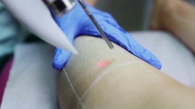 Profesyonel güzellik uzmanı, güzellik salonunda kadın bacağı üzerinde lazer tüyü çıkarma prosedürü uyguluyor. Etkili ve acısız vücut kıllarını almak için modern ekipmanlar kullanıyor.