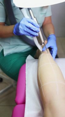 Profesyonel güzellik uzmanı, güzellik salonunda kadın bacağı üzerinde lazer tüyü çıkarma prosedürü uyguluyor. Etkili ve acısız vücut kıllarını almak için modern ekipmanlar kullanıyor.