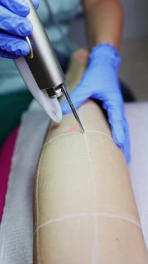 Profesyonel güzellik uzmanı, güzellik salonunda kadın bacağı üzerinde lazer tüyü çıkarma prosedürü uyguluyor. Etkili ve acısız vücut kıllarını almak için modern ekipmanlar kullanıyor.