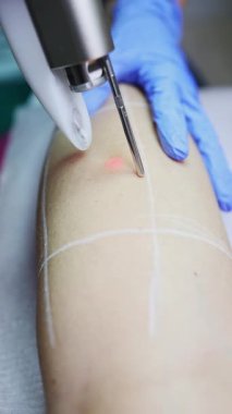 Profesyonel güzellik uzmanı, güzellik salonunda kadın bacağı üzerinde lazer tüyü çıkarma prosedürü uyguluyor. Etkili ve acısız vücut kıllarını almak için modern ekipmanlar kullanıyor.