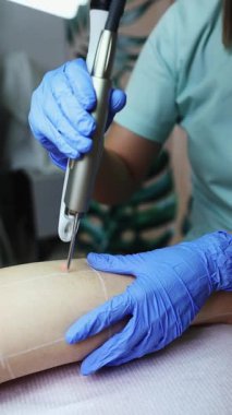 Profesyonel güzellik uzmanı, güzellik salonunda kadın bacağı üzerinde lazer tüyü çıkarma prosedürü uyguluyor. Etkili ve acısız vücut kıllarını almak için modern ekipmanlar kullanıyor.