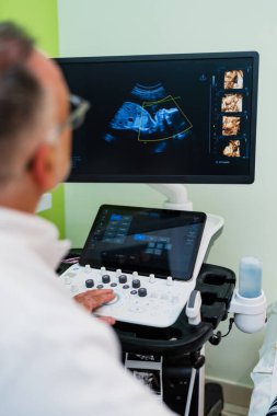 Jinekolog, hamile kadını muayene etmek için modern ultrason tarayıcısı kullanıyor. Klinikteki 4D fetüs görüntülerini gözlemliyor. Doğum öncesi teşhisi koyuyor.