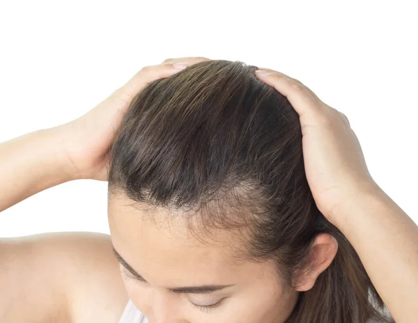 Close Woman Hand Holding Hair Loss Problem Health Care Shampoo — Stock Photo, Image