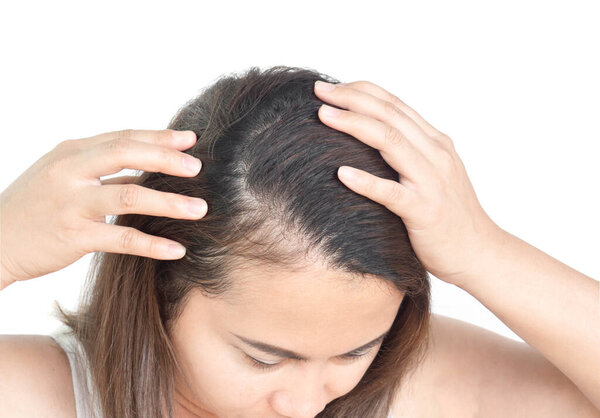 Крупный план женщина зуд кожи головы, для ухода за здоровьем шампунь и косметика концепция ухода за волосами