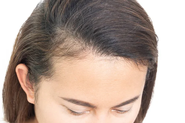 Closeup Woman Hand Itchy Scalp Health Care Shampoo Beauty Product — Stock Photo, Image