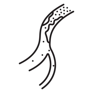 Yüksek kolesterol veya atheroskleroz ikonu. Atardamar kolesterol ile tıkandı, vektör illüstrasyonu