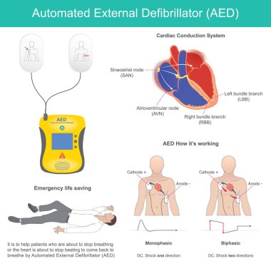 Otomatik dış defibrilatör. Ventriküler fibrilasyonu ve diğer disritmileri tanıyan ve doğru zamanda elektrik şoku veren elektronik bir cihaz.