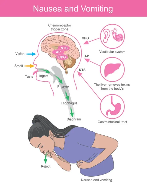 吐き気や嘔吐 脳プロセスの影響である吐き気や嘔吐の症状を持つ女性 — ストックベクタ