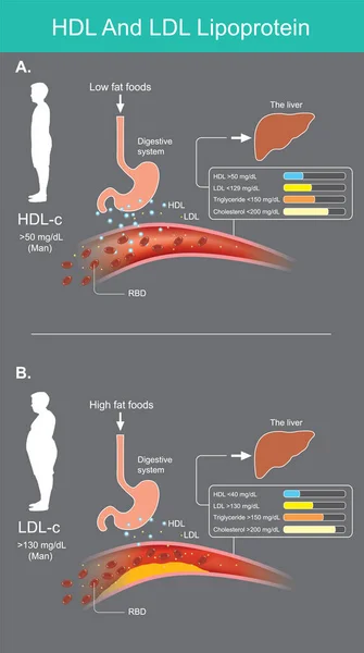 HdlとLdlリポタンパク質 実験室血液検査からの血液中の脂質レベルの評価 ベクトルインフォグラフィック — ストックベクタ