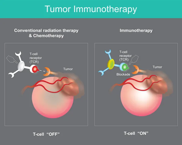 Inmunoterapia Tumoral Tratamiento Del Cáncer Que Utiliza Propio Sistema Inmunitario — Vector de stock