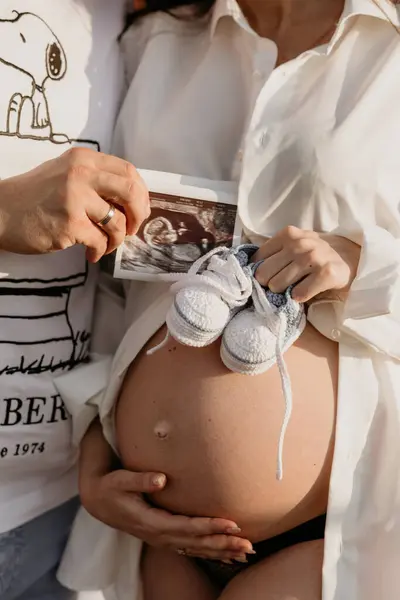 Hamile karnı, ebeveyn elleri, ultrason fotoğrafı, gelecekteki aileler.
