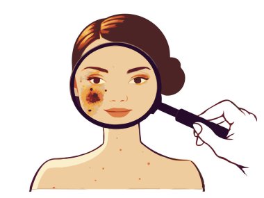 Bir dermatolog, beyaz arka planda izole edilmiş bir hastanın derisindeki beni incelemek için büyüteç kullanıyor..