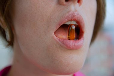 Kız dişlerinin arasında ilaç ya da vitamin içeren bir kapsül tutuyor. Bir kadının ağzındaki hapın yakın plan fotoğrafı. Ağız ilacı, dudaklar ve dişler..