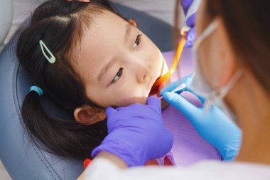 Steril eldivenli dişçi diş etlerini diş eti için anestezi yapılmadan önce ağrı kesici merhemle hazırlarken genç kız sakince oturur..