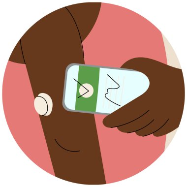 Kan şekeri monitörü takan bir kadın. Sürekli glikoz monitörü. Diyabet yönetimi ve sağlık teknolojisi.