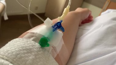 Kadın hasta, damar içi kateterle hastane yatağında uykusuzluk çekiyor. Periferik damar içi kateter..