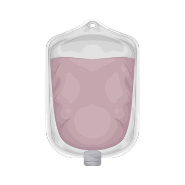 An IV bag is a fluid-filled pouch connected to a catheter to deliver medication, nutrients, or hydration directly into a patients bloodstream