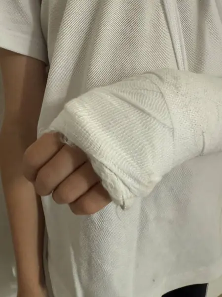 Yaralanan kol, kazadan sonra beyaz bandajla sarılmış.. 