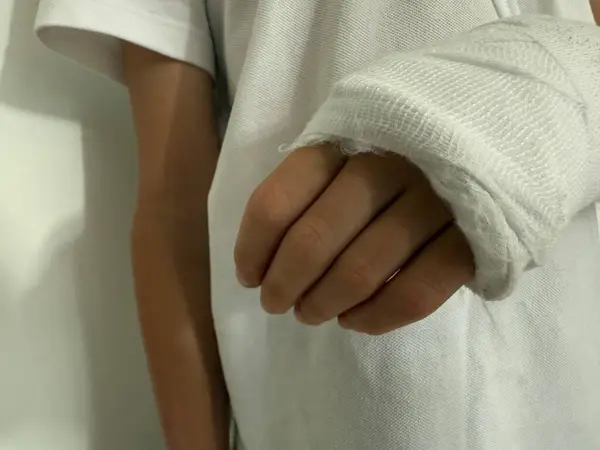 Yaralanan kol, kazadan sonra beyaz bandajla sarılmış.. 