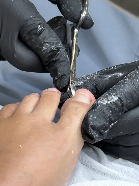 Profesyonel tırnak uçlarını kullanarak ayak tırnaklarını kesen pediatrist.. 