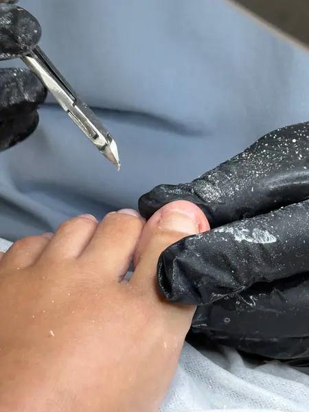 Profesyonel tırnak uçlarını kullanarak ayak tırnaklarını kesen pediatrist.. 