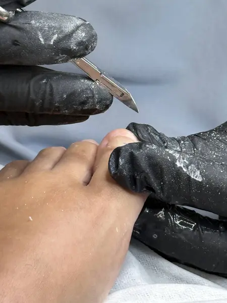 Profesyonel tırnak uçlarını kullanarak ayak tırnaklarını kesen pediatrist.. 