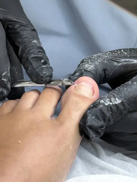 Profesyonel tırnak uçlarını kullanarak ayak tırnaklarını kesen pediatrist.. 