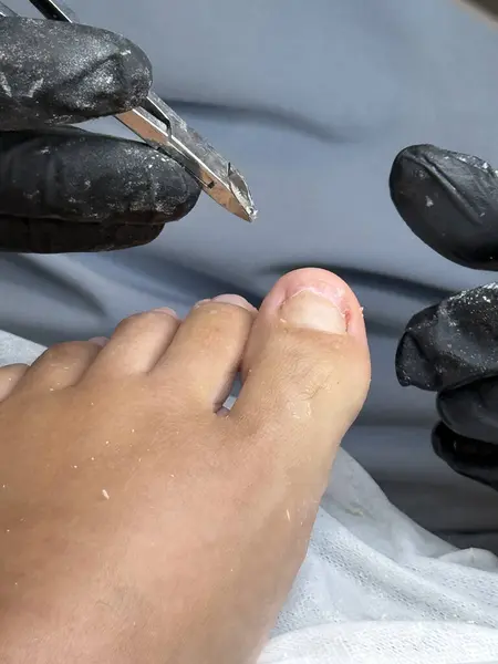 Profesyonel tırnak uçlarını kullanarak ayak tırnaklarını kesen pediatrist.. 