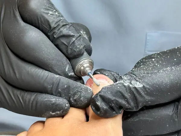 Ayak tırnaklarını tıbbi bakım sırasında matkapla tedavi eden ayak hastalıkları uzmanı.. 