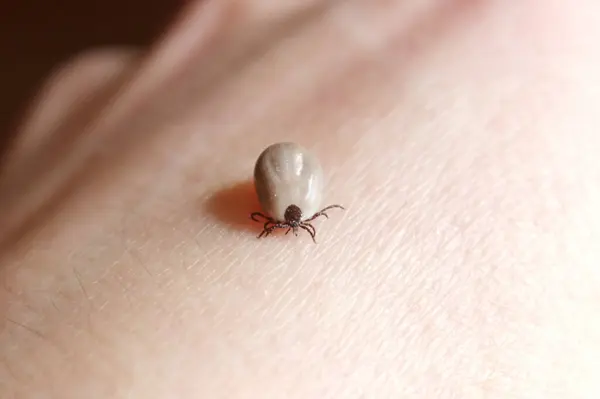 Tıkanmış kene insan derisi üzerinde sürünüyor. Yaklaş.