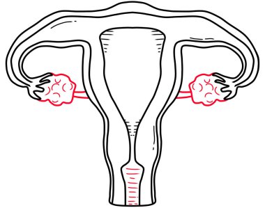 İnsan rahmi ve yumurtalık yapısının kırmızı ve siyah çizgisi çizimi