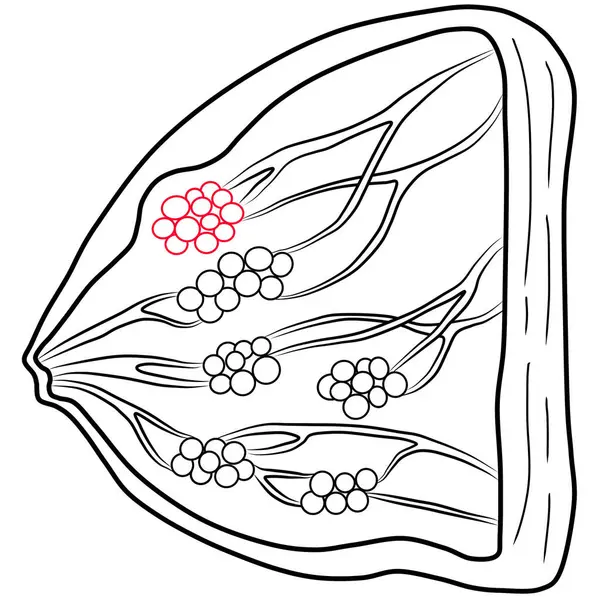 İnsan göğüs kanseri yapısının kırmızı ve siyah çizgi çizimi
