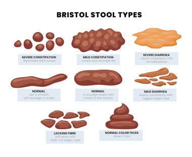 Çeşitli tipte insan dışkısı. Kabızlık, normal ve ishal. Bristol dışkısı, farklı tipte dışkı, sağlıklı mide ve sindirim hastalıkları. vektör illüstrasyonu.