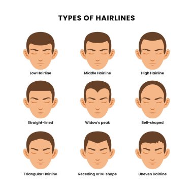Düşük, orta, yüksek, düz çizgili, dulun zirvesi, çan şeklinde, üçgen şeklinde, geri çekilen, m şeklinde, dengesiz olan farklı saç çizgileri posteri koyun. Güzel saç stili, moda saç kesimi, moda berber..