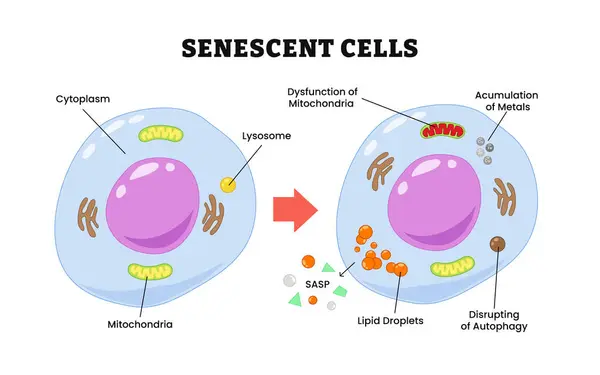 Senescent hücre süreci, etiketli sitoplazma, mitokondri, lizozom mitokondri bozukluğu, mitokondri bozukluğu, metallerin birikmesi, SASP, lipid damlacıklar, otopsiyi bozma. Biyoloji eğitimi.