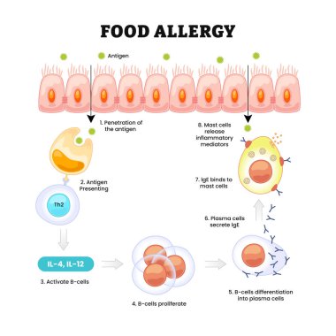 Gıda alerjisi, yiyeceğe anormal bağışıklık tepkisi, etiketli antijen girişi, sunum, TH2, B hücresi etkinleştirme ve çoğalma, plazma hücresi, IgE, mast hücresi, iltihaplı arabulucu. Biyoloji eğitimi
