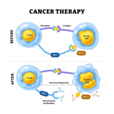 Kanser Terapisi Diyagram İşlemi. Sağlık hizmetleri poster tasarımı, monoklonal antikorlar tümör hücrelerinin bağışıklık tepkisini baypas etmesini engeller, etiketli reseptör, antijen, t-hücresi, tümör hücresi, monoklonal antikor